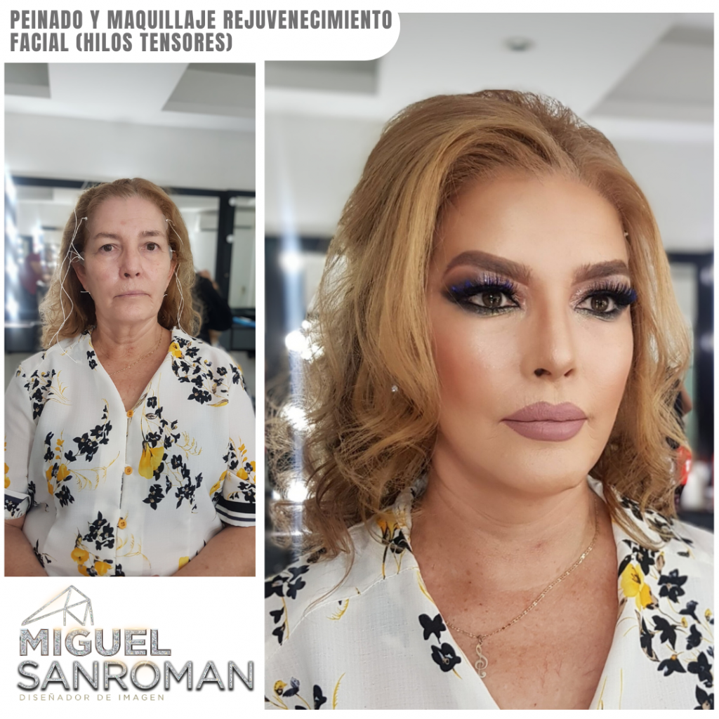 Rejuvenecimiento página (1)