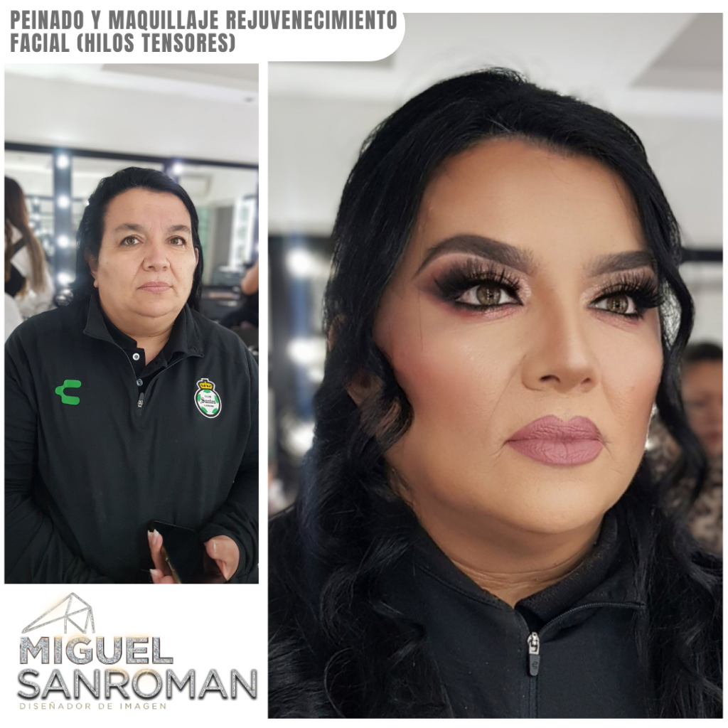 Rejuvenecimiento página