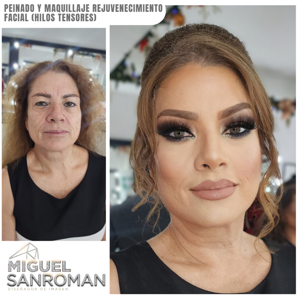 Rejuvenecimiento página (3)